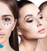 botox_fillers